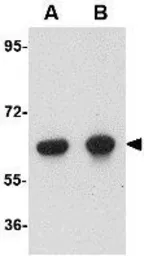 Anti-OTUD5 antibody used in Western Blot (WB). GTX31361