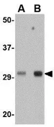 Anti-TREX1 antibody used in Western Blot (WB). GTX31367
