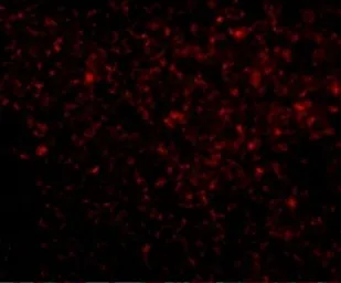 Anti-TREX1 antibody used in IHC (Paraffin sections) (IHC-P). GTX31367