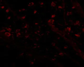 Anti-CRMP1 antibody used in IHC (Paraffin sections) (IHC-P). GTX31369