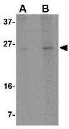 Anti-RCAN2 antibody used in Western Blot (WB). GTX31373