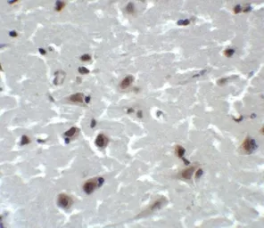Anti-CD81 antibody used in IHC (Paraffin sections) (IHC-P). GTX31381