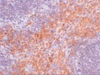 Anti-RIP antibody used in IHC (Paraffin sections) (IHC-P). GTX31389