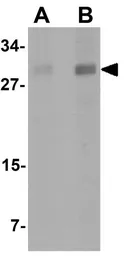Anti-ATG101 antibody used in Western Blot (WB). GTX31415