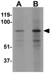 Anti-EZH1 antibody used in Western Blot (WB). GTX31434