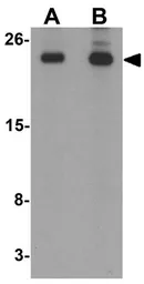 Anti-Translin antibody used in Western Blot (WB). GTX31440