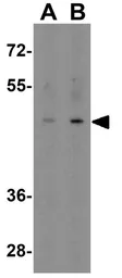 Anti-EED antibody used in Western Blot (WB). GTX31494