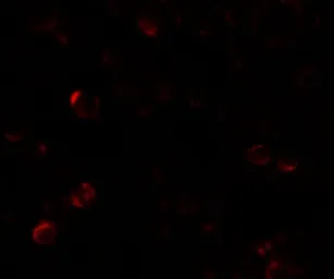 Anti-Laforin antibody used in Immunocytochemistry/ Immunofluorescence (ICC/IF). GTX31495