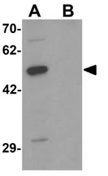 Anti-DCP2 antibody used in Western Blot (WB). GTX31499