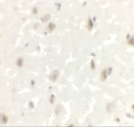 Anti-LMX1A antibody used in IHC (Paraffin sections) (IHC-P). GTX31507