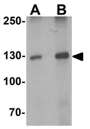 Anti-TYK2 antibody used in Western Blot (WB). GTX31515