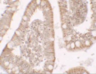 Anti-RC3H1 antibody used in IHC (Paraffin sections) (IHC-P). GTX31528