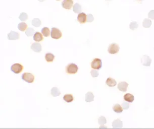 Anti-KREMEN2 antibody used in Immunocytochemistry/ Immunofluorescence (ICC/IF). GTX31529