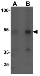Anti-KREMEN2 antibody used in Western Blot (WB). GTX31529