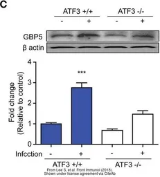 Anti-GBP5 antibody used in Western Blot (WB). GTX31537