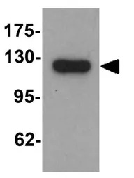 Anti-Lipin 1 antibody used in Western Blot (WB). GTX31547