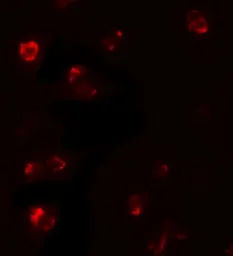 Anti-TBX21 antibody used in Immunocytochemistry/ Immunofluorescence (ICC/IF). GTX31554