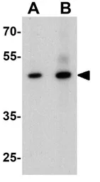Anti-CERD4 antibody used in Western Blot (WB). GTX31560