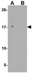 Anti-IL22 antibody used in Western Blot (WB). GTX31563