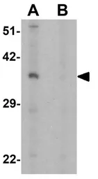 Anti-OLIG2 antibody used in Western Blot (WB). GTX31569
