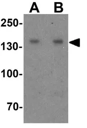 Anti-WAPL antibody used in Western Blot (WB). GTX31577