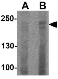 Anti-DOCK8 antibody used in Western Blot (WB). GTX31578