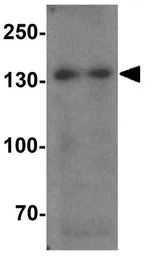 Anti-SREBP1 antibody used in Western Blot (WB). GTX31579