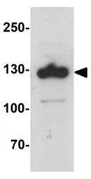 Anti-SREBP2 antibody used in Western Blot (WB). GTX31580