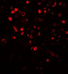 Anti-NOX4 antibody used in IHC (Paraffin sections) (IHC-P). GTX31588