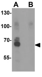 Anti-NOX4 antibody used in Western Blot (WB). GTX31588
