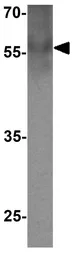 Anti-E2F3 antibody used in Western Blot (WB). GTX31589