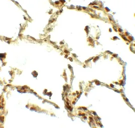Anti-BAMBI antibody used in IHC (Paraffin sections) (IHC-P). GTX31590