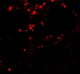 Anti-BAMBI antibody used in IHC (Paraffin sections) (IHC-P). GTX31590