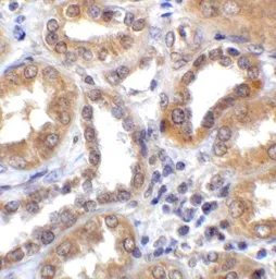 Anti-TXNIP antibody used in IHC (Paraffin sections) (IHC-P). GTX31592