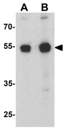 Anti-P2X7 antibody used in Western Blot (WB). GTX31600