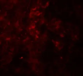 Anti-SESN2 antibody used in IHC (Paraffin sections) (IHC-P). GTX31602