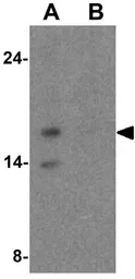 Anti-HES5 antibody used in Western Blot (WB). GTX31605