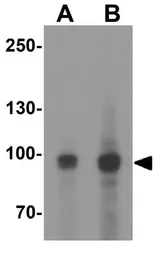 Anti-MALT1 antibody used in Western Blot (WB). GTX31609