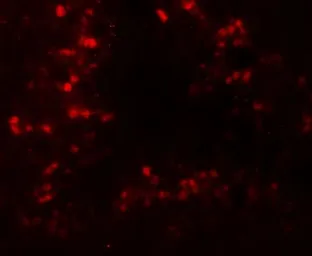 Anti-CRBN antibody used in IHC (Paraffin sections) (IHC-P). GTX31611