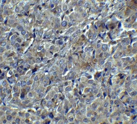 Anti-MAGEA4 antibody used in IHC (Paraffin sections) (IHC-P). GTX31620