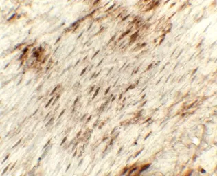 Anti-Golgin 97 antibody used in IHC (Paraffin sections) (IHC-P). GTX31624