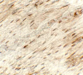 Anti-Hexokinase 1 antibody used in IHC (Paraffin sections) (IHC-P). GTX31625