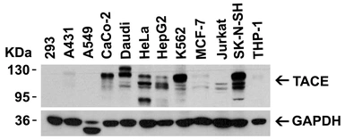 Anti-ADAM17 antibody used in Western Blot (WB). GTX31632