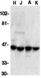 Anti-ICAD antibody used in Western Blot (WB). GTX31635