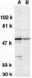 Anti-DRAK1 antibody used in Western Blot (WB). GTX31646