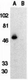 Anti-CX3CR1 antibody used in Western Blot (WB). GTX31648