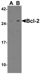 Anti-Bcl-2 antibody used in Western Blot (WB). GTX31686