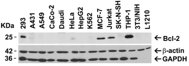 Anti-Bcl-2 antibody used in Western Blot (WB). GTX31687