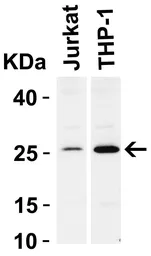Anti-Bcl-2 antibody used in Western Blot (WB). GTX31687
