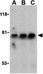 Anti-BTK antibody used in Western Blot (WB). GTX31694